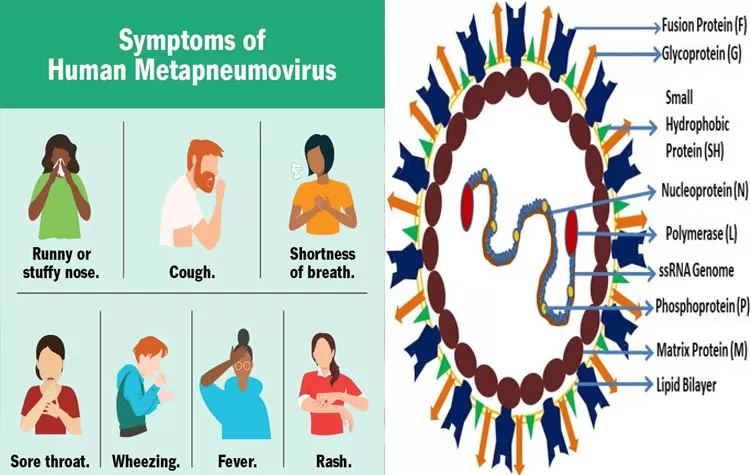 understanding-human-metapneumovirus-hmpv-detailed-overview